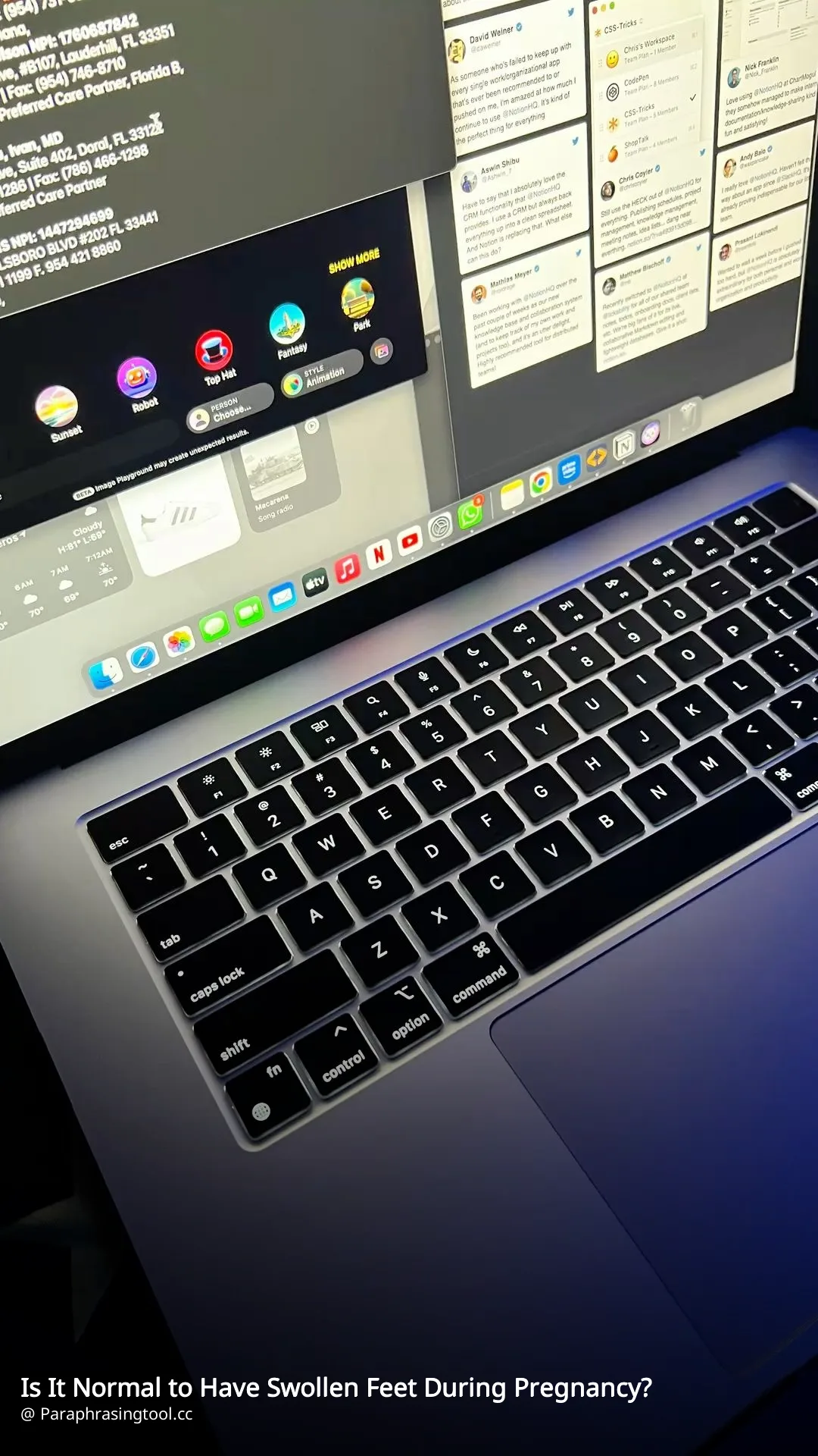 Is It Normal to Have Swollen Feet During Pregnancy?