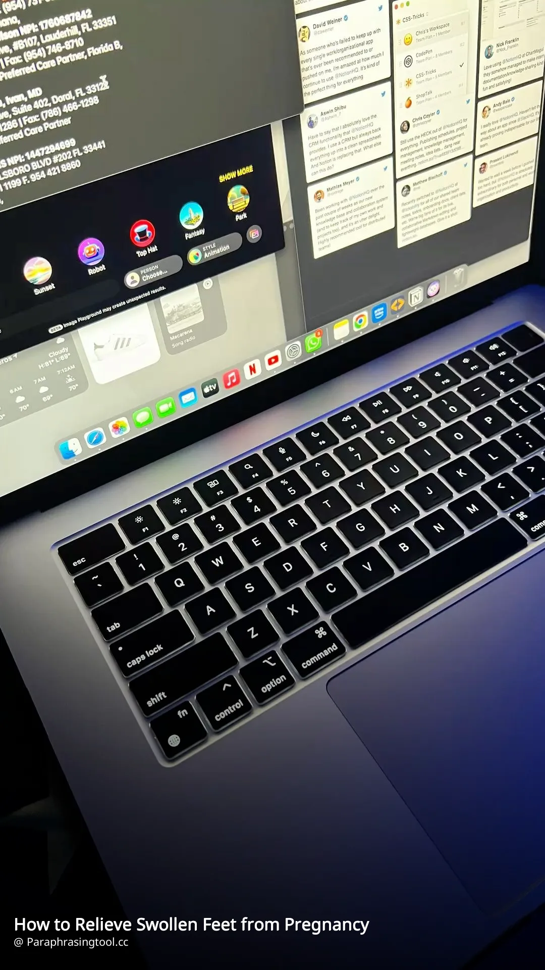 How to Relieve Swollen Feet from Pregnancy