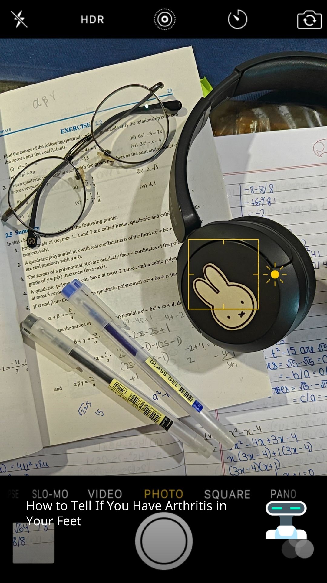 How to Tell If You Have Arthritis in Your Feet